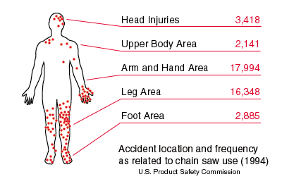 This figure maps the chain saw injuries to the body in one year. It demonstrates the need to protect the whole body.