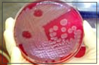 Disease Agents and Toxins