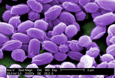 Magnifying 31,207 times the actual size, this scanning electron micrograph (SEM) shows spores from the Sterne strain of Bacillus anthracis bacteria. These spores can live for decades, which enables the bacteria to survive in a dormant state. CDC/Janice Haney Carr.